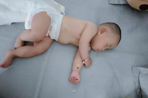 靖江宝宝脸上有白色斑块